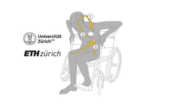 Tiefe Hirnstimulation zur Verbesserung der Gangfunktion