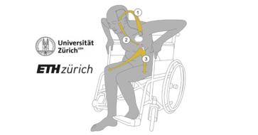 Tiefe Hirnstimulation zur Verbesserung der Gangfunktion