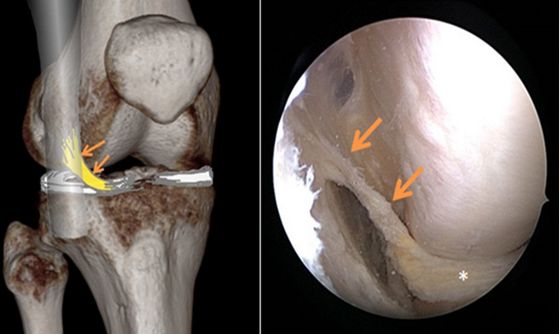 Forscher entdecken neues Band am Knie