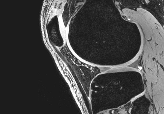Neue Massstäbe in der 7T-MRI-Bildgebung
