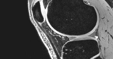 Neue Massstäbe in der 7T-MRI-Bildgebung